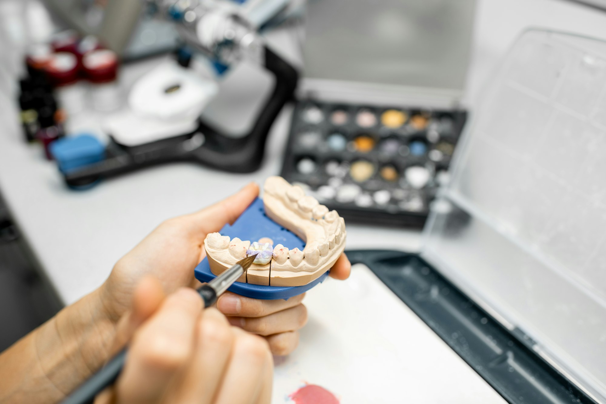 Dental technician coloring dental prosthesis